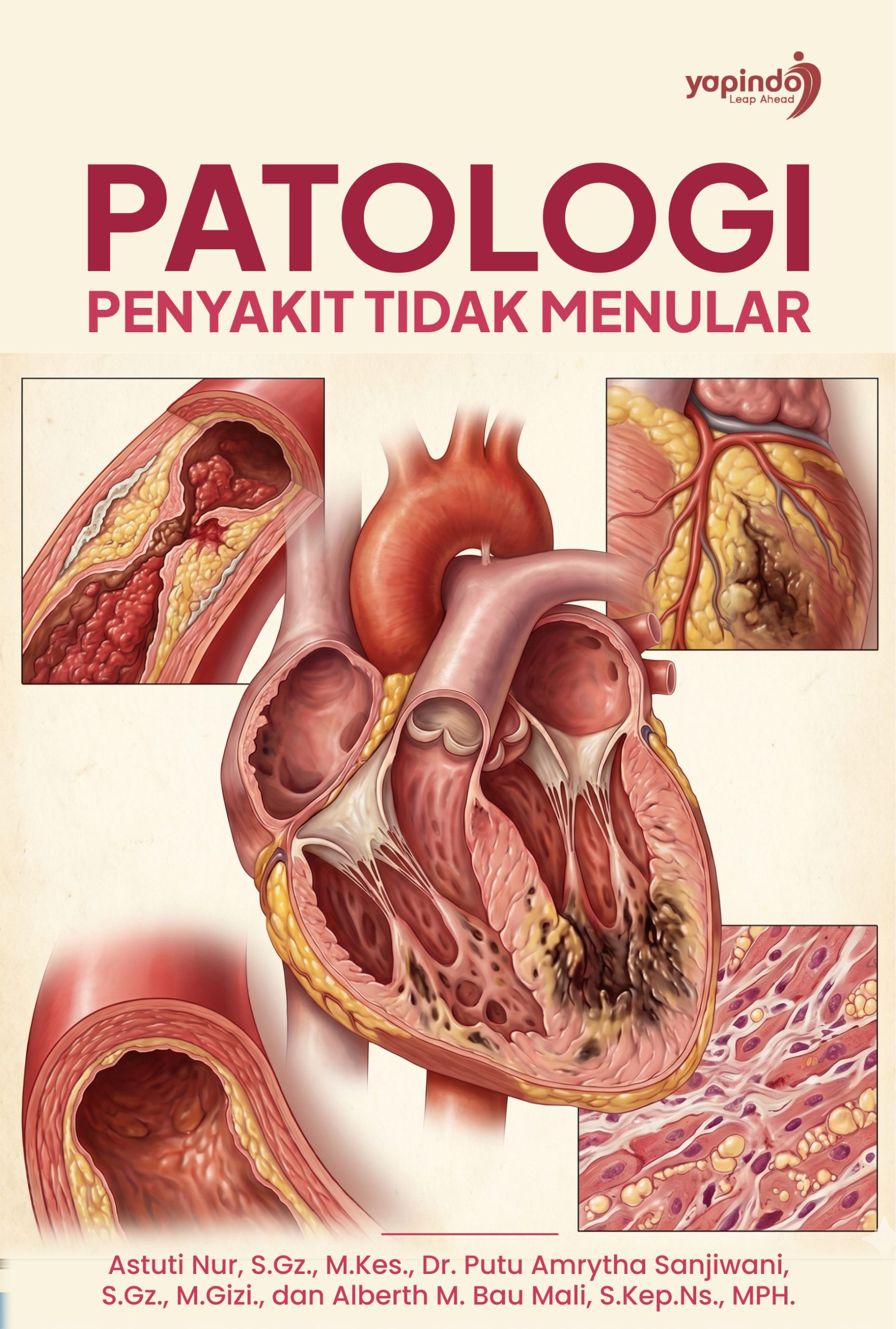 Patologi Penyakit Tidak Menular